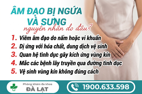 Hình ảnh minh họa